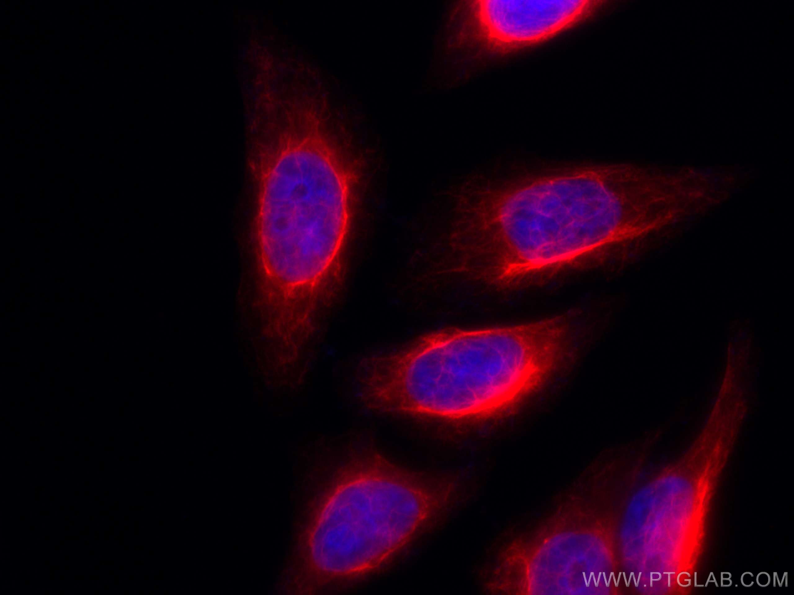 Immunofluorescence (IF) / fluorescent staining of HepG2 cells using CoraLite®594-conjugated Vimentin Polyclonal antibo (CL594-10366)