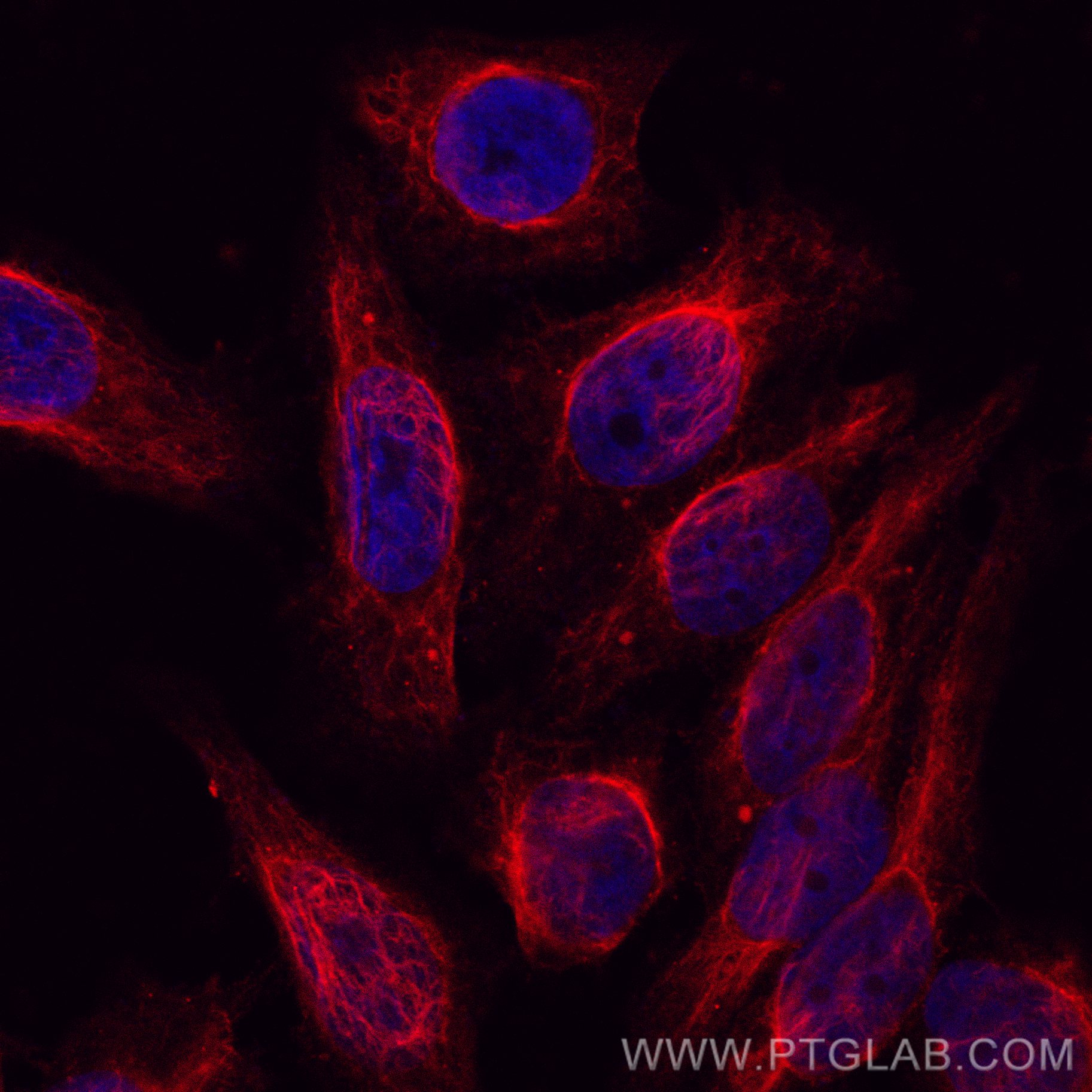 Immunofluorescence (IF) / fluorescent staining of HepG2 cells using CoraLite®594-conjugated Vimentin Polyclonal antibo (CL594-10366)