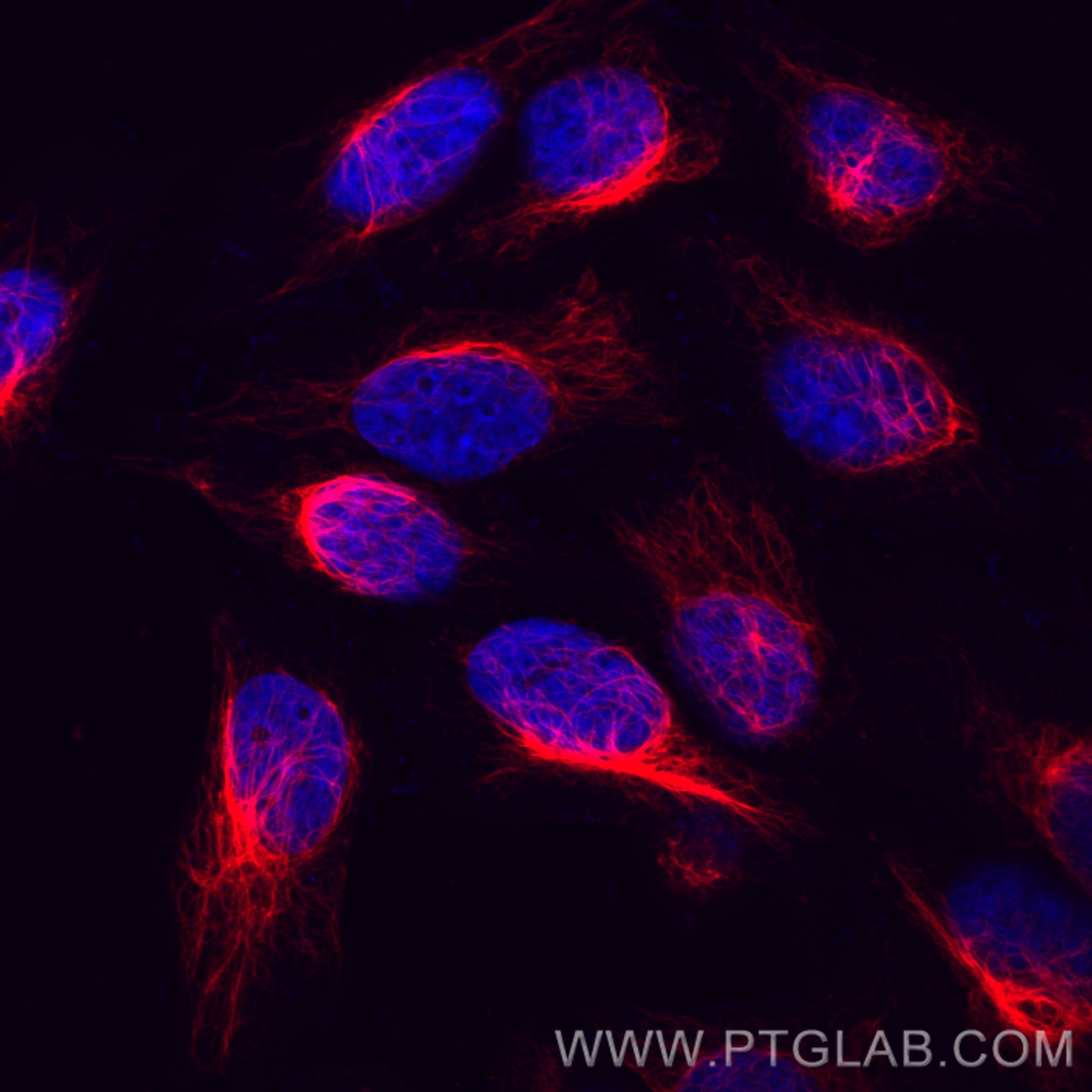 Immunofluorescence (IF) / fluorescent staining of HepG2 cells using CoraLite®594-conjugated Vimentin Monoclonal antibo (CL594-60330)