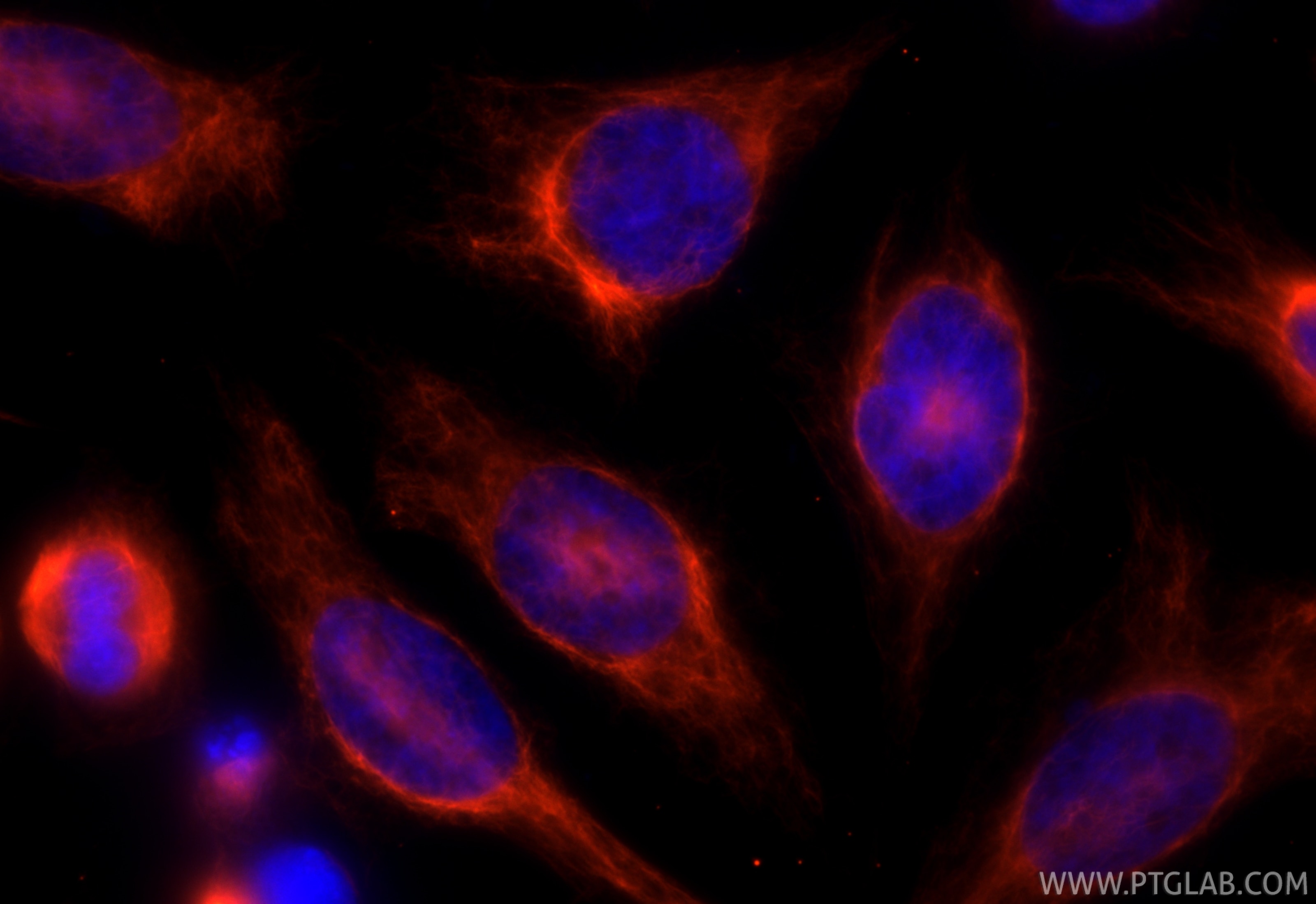 Immunofluorescence (IF) / fluorescent staining of HeLa cells using CoraLite®594-conjugated Vimentin Monoclonal antibo (CL594-60330)