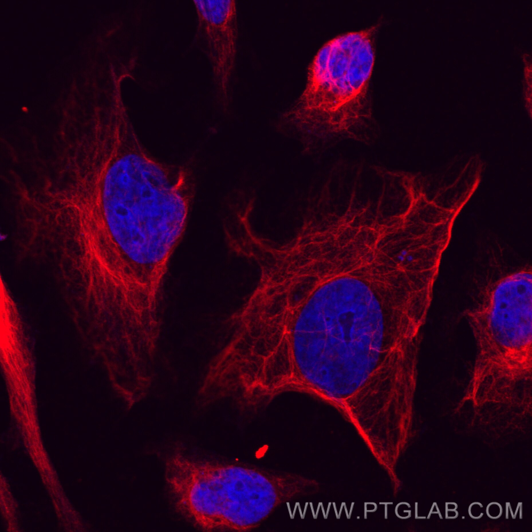 Immunofluorescence (IF) / fluorescent staining of HeLa cells using CoraLite®594-conjugated Vimentin Recombinant antib (CL594-80232)