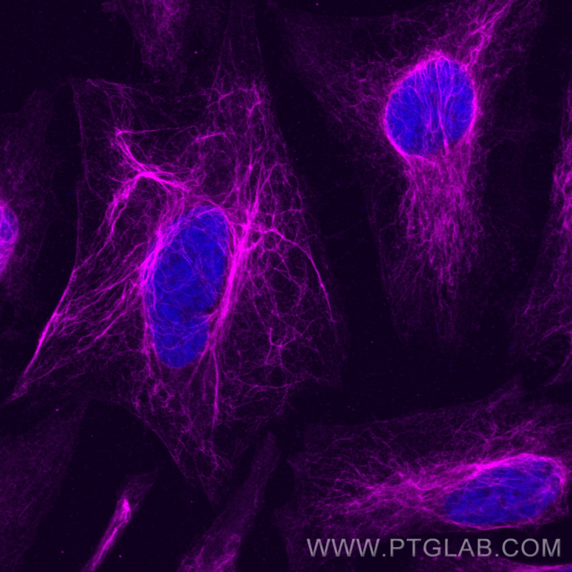 Immunofluorescence (IF) / fluorescent staining of HeLa cells using CoraLite® Plus 647-conjugated Vimentin Recombinant (CL647-80232)