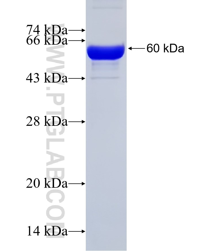 Vimentin fusion protein Ag28446 SDS-PAGE