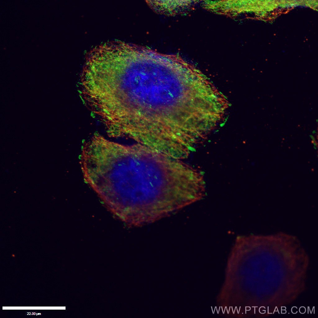 IF Staining of HepG2 using 26520-1-AP