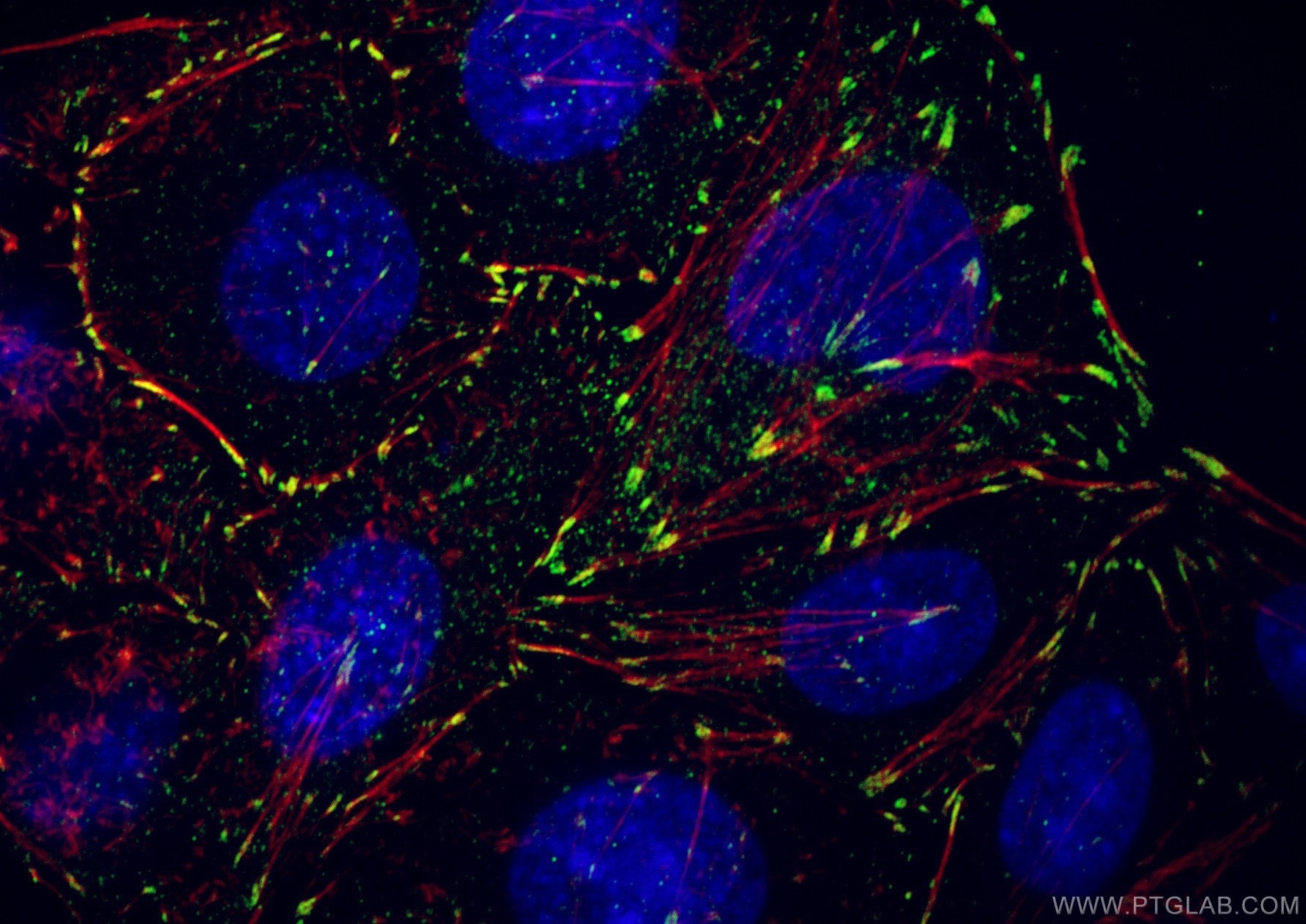 Immunofluorescence (IF) / fluorescent staining of HepG2 cells using Vinculin Polyclonal antibody (26520-1-AP)