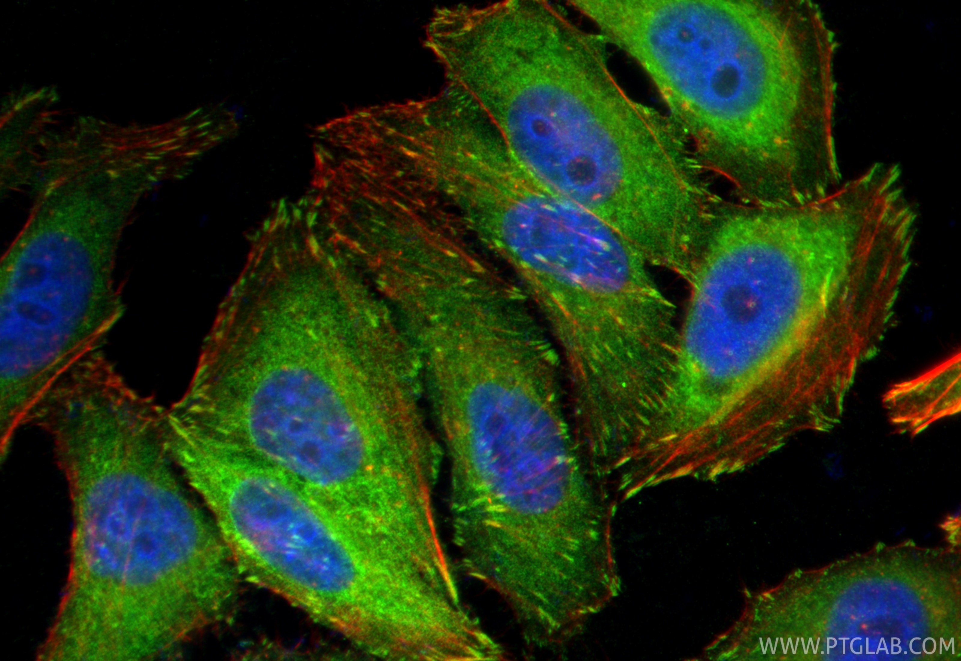 Immunofluorescence (IF) / fluorescent staining of HepG2 cells using Vinculin Polyclonal antibody (26520-1-AP)