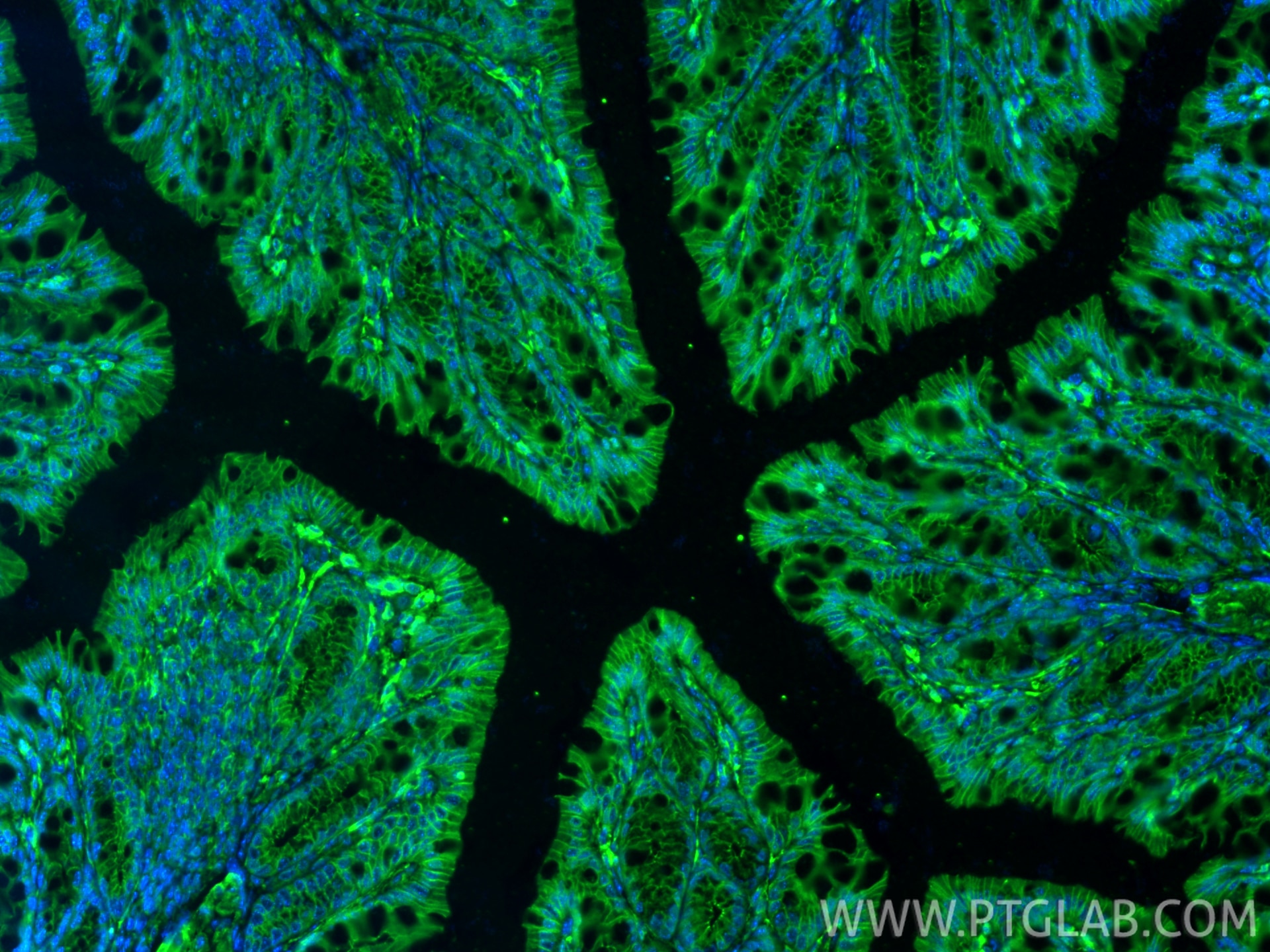 Immunofluorescence (IF) / fluorescent staining of mouse colon tissue using Vinculin Polyclonal antibody (26520-1-AP)