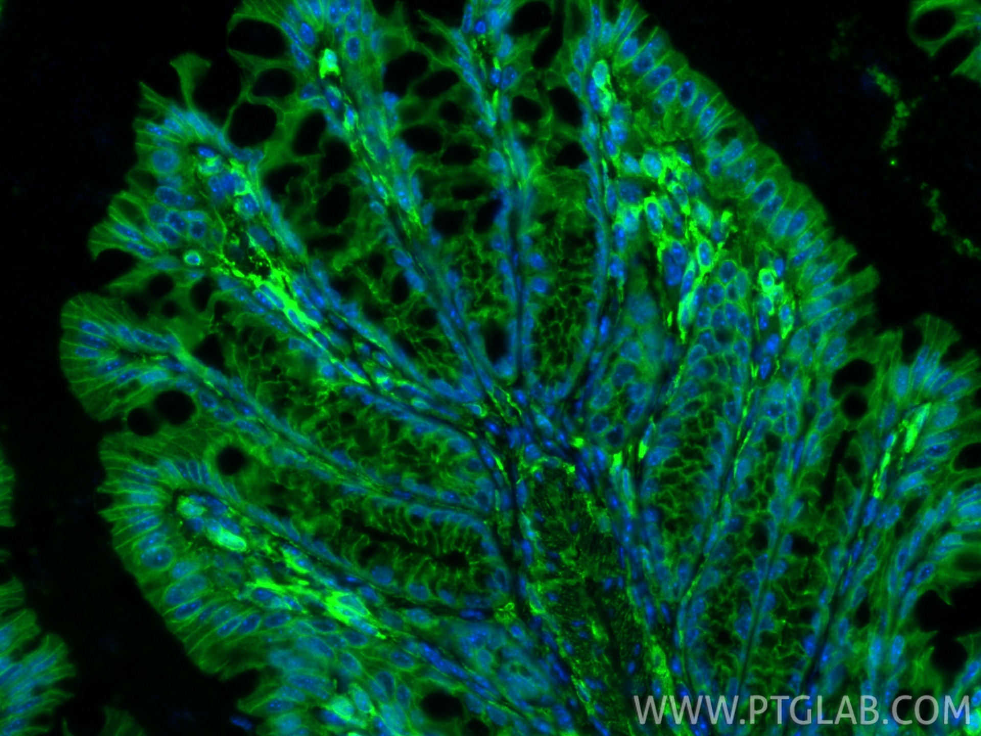 Immunofluorescence (IF) / fluorescent staining of mouse colon tissue using Vinculin Polyclonal antibody (26520-1-AP)