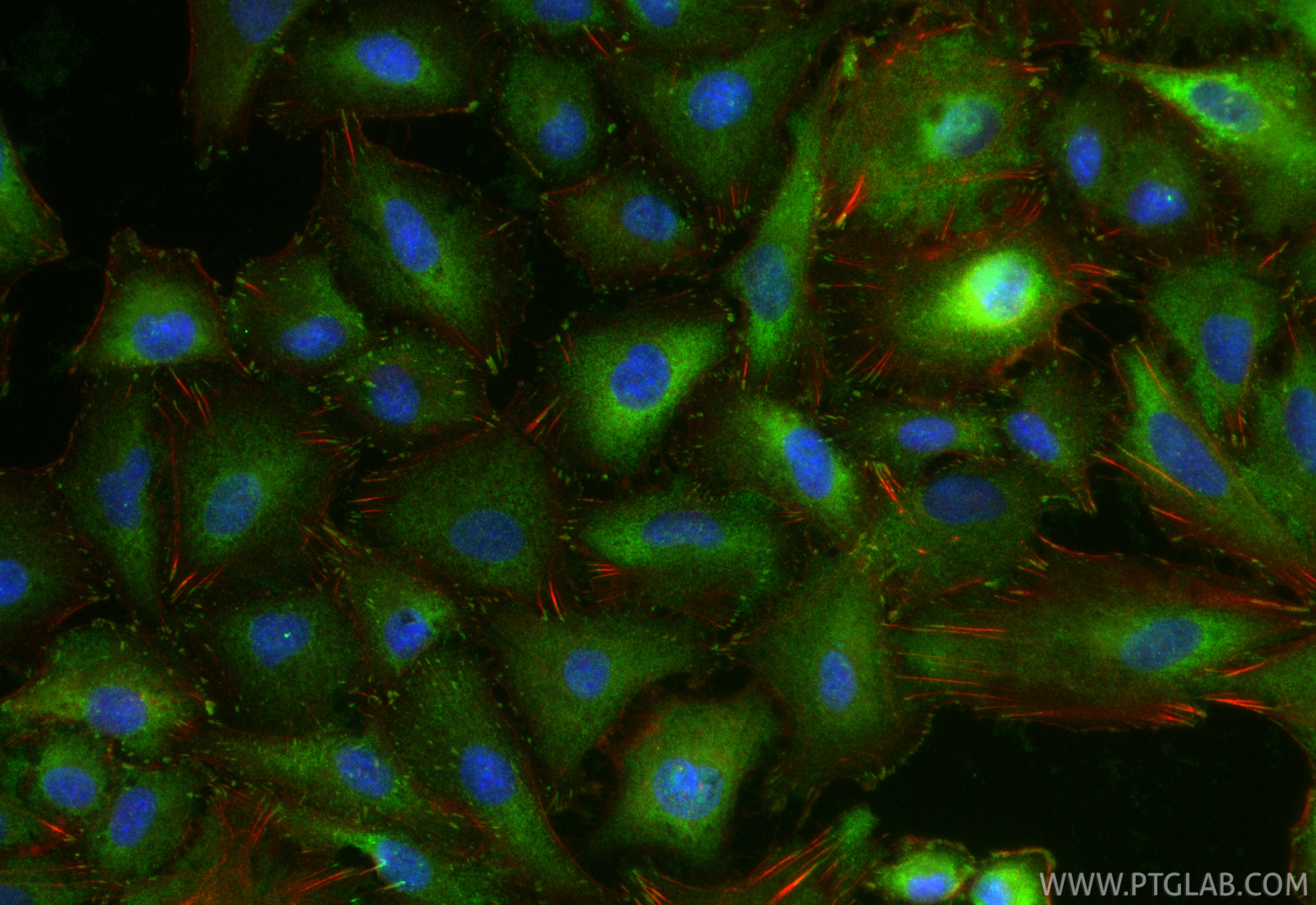 IF Staining of A549 using 26520-1-AP Immunofluorescence (IF) / fluorescent staining of A549 cells using Vinculin Polyclonal antibody (26520-1-AP)