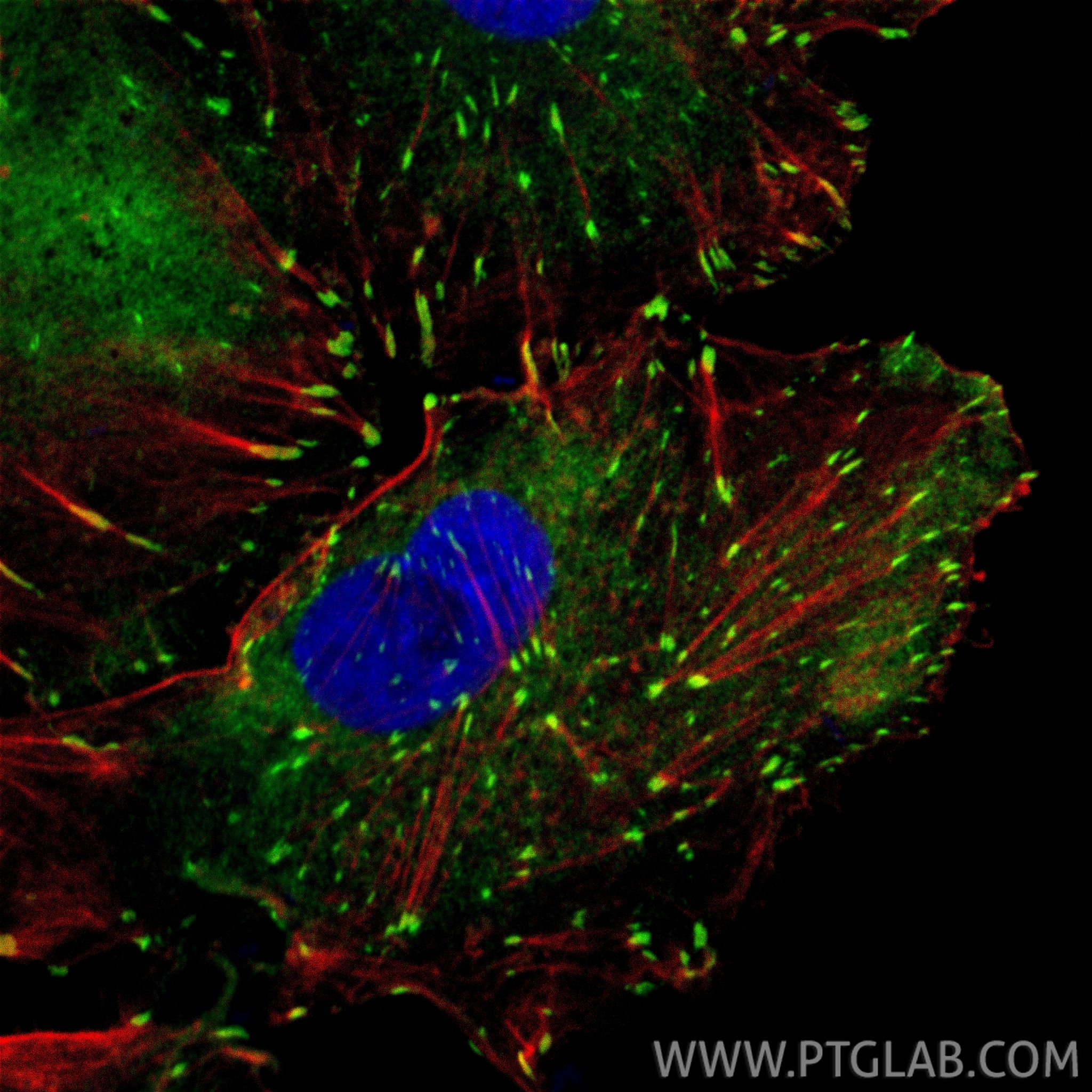 IF Staining of A549 using 26520-1-AP Immunofluorescence (IF) / fluorescent staining of A549 cells using Vinculin Polyclonal antibody (26520-1-AP)
