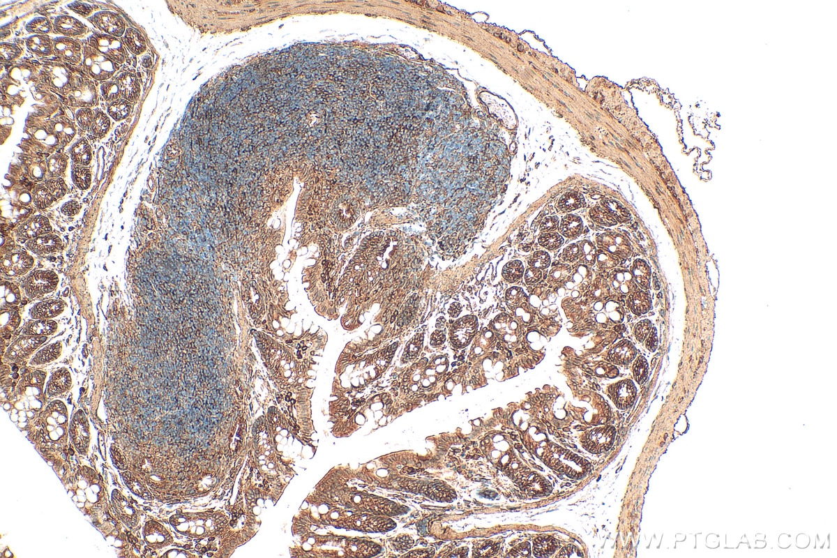 IHC staining of mouse colon using 26520-1-AP