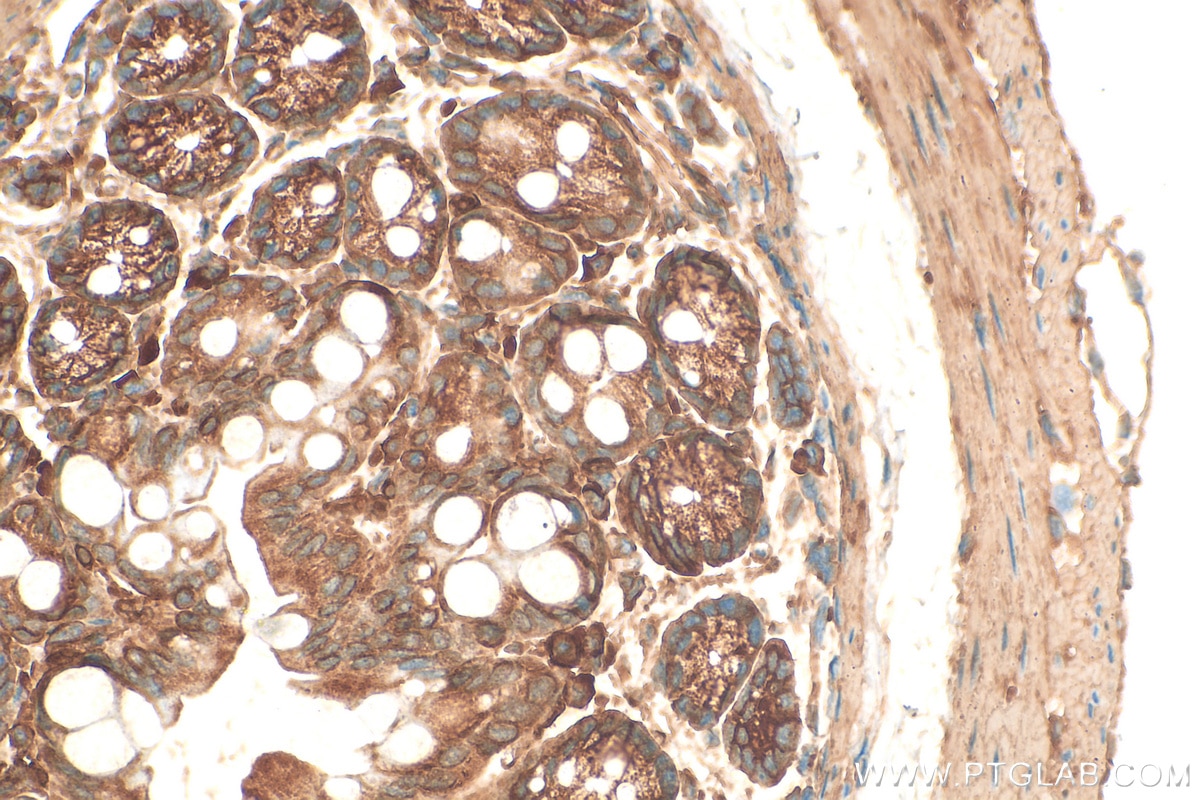 Immunohistochemistry (IHC) staining of mouse colon tissue using Vinculin Polyclonal antibody (26520-1-AP)
