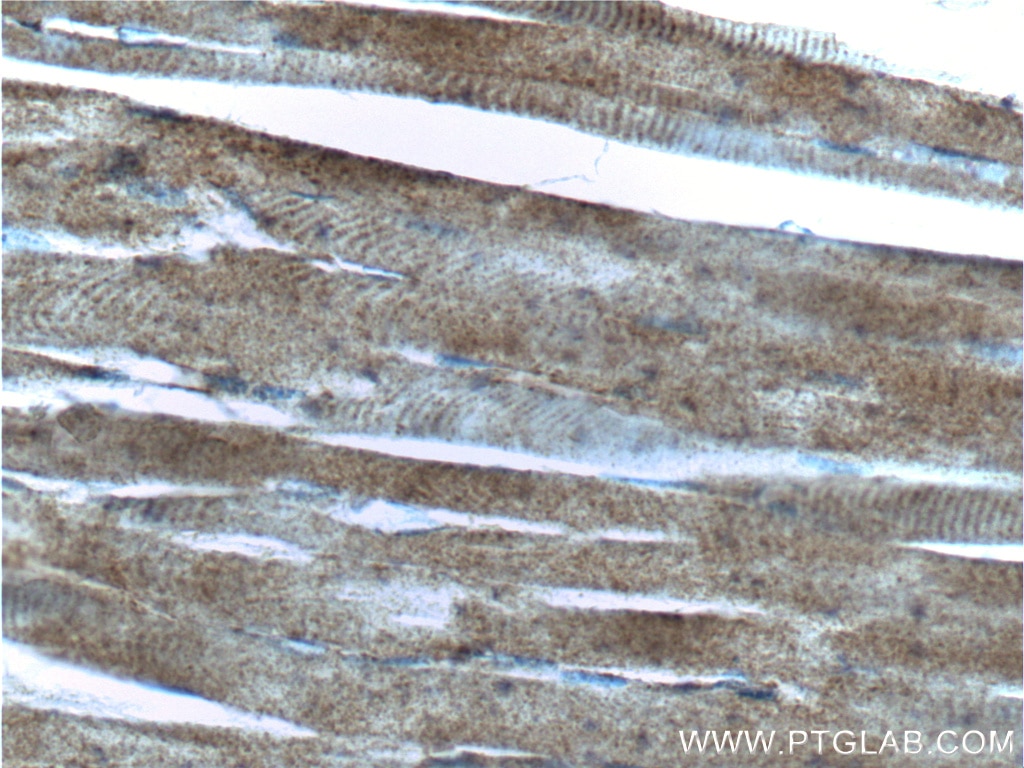 Immunohistochemistry (IHC) staining of human skeletal muscle tissue using Vinculin Polyclonal antibody (26520-1-AP)