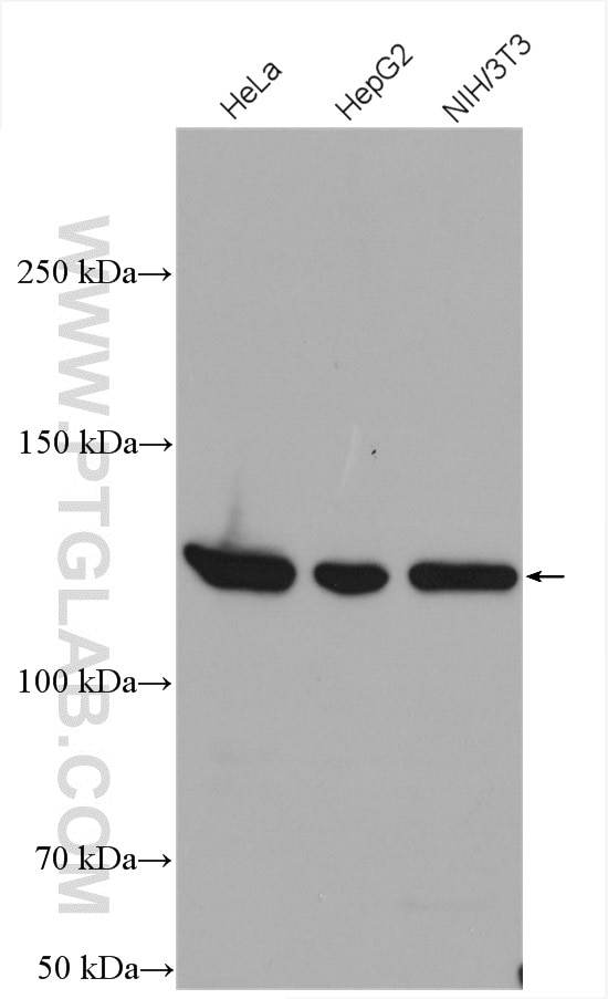 Vinculin