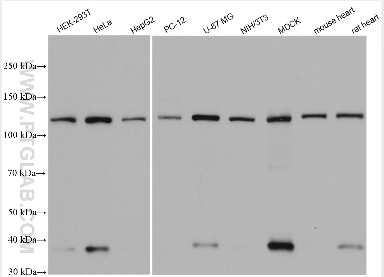 Western Blot (WB) analysis of various lysates using Vinculin Polyclonal antibody (26520-1-AP)