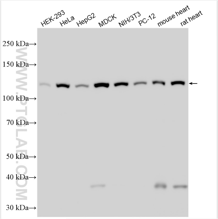 Western Blot (WB) analysis of various lysates using Vinculin Polyclonal antibody (26520-1-AP)