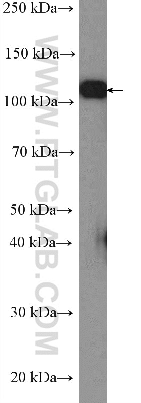 Vinculin Polyclonal antibody