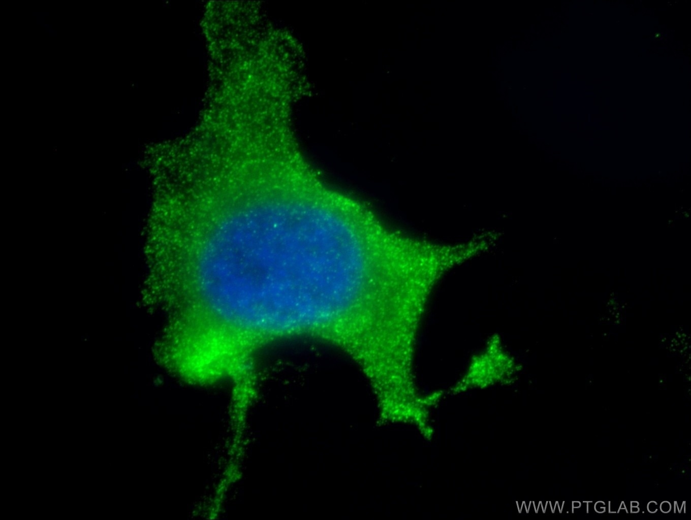 Immunofluorescence (IF) / fluorescent staining of HeLa cells using Vinculin Monoclonal antibody (66305-1-Ig)