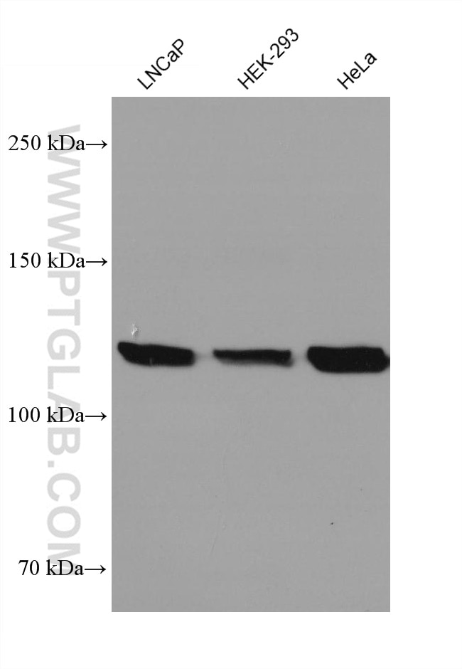 Western Blot (WB) analysis of various lysates using Vinculin Monoclonal antibody (66305-1-Ig)