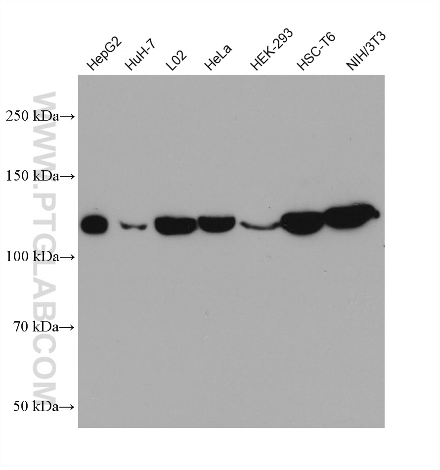 Western Blot (WB) analysis of various lysates using Vinculin Monoclonal antibody (66305-1-Ig)