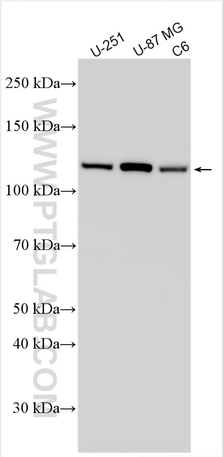 Western Blot (WB) analysis of various lysates using Vinculin Monoclonal antibody (66305-1-Ig)