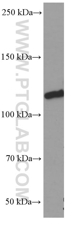 Western Blot (WB) analysis of pig heart tissue using Vinculin Monoclonal antibody (66305-1-Ig)