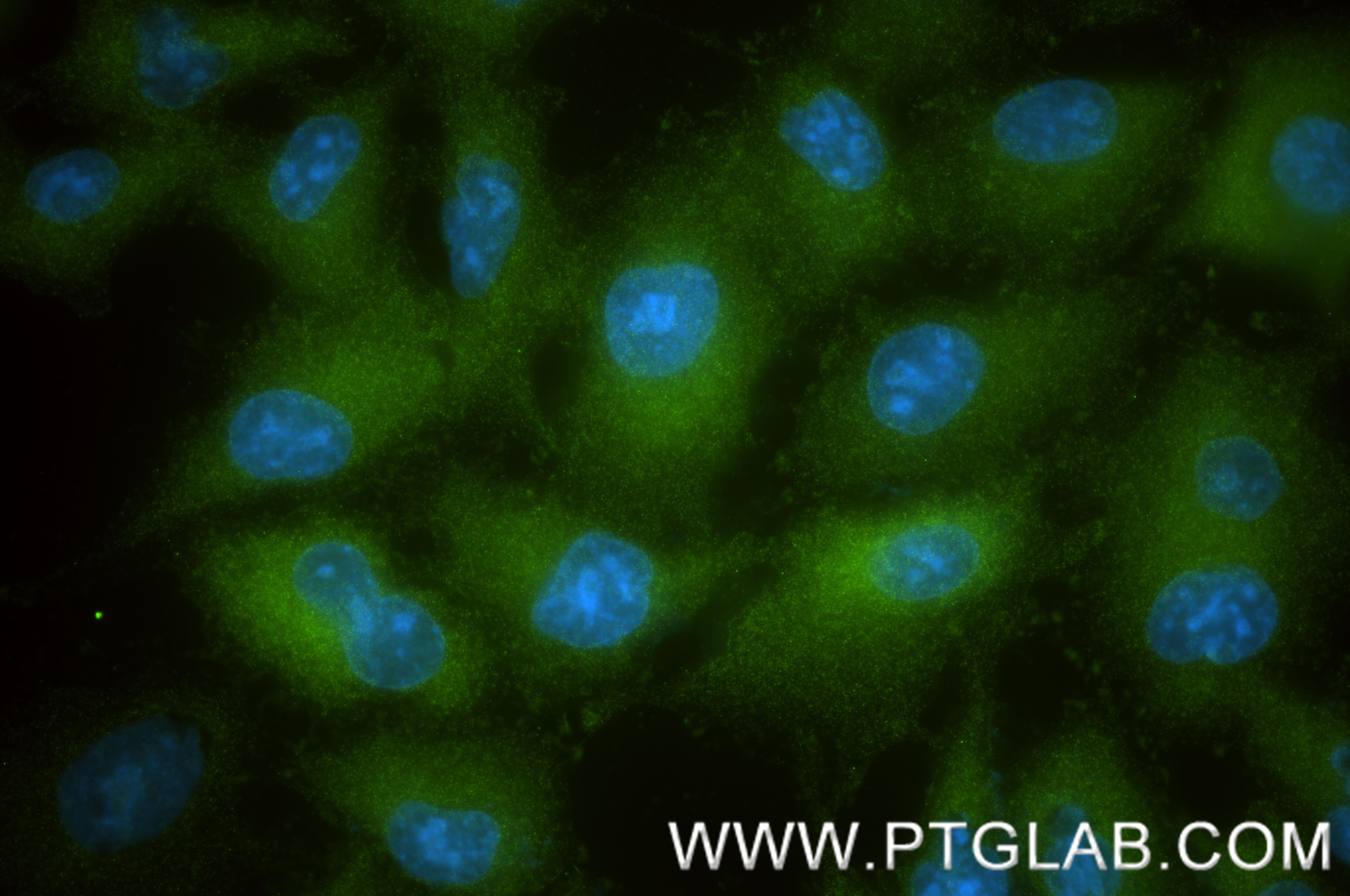 Immunofluorescence (IF) / fluorescent staining of A549 cells using Vinculin Recombinant monoclonal antibody (86930-1-RR)