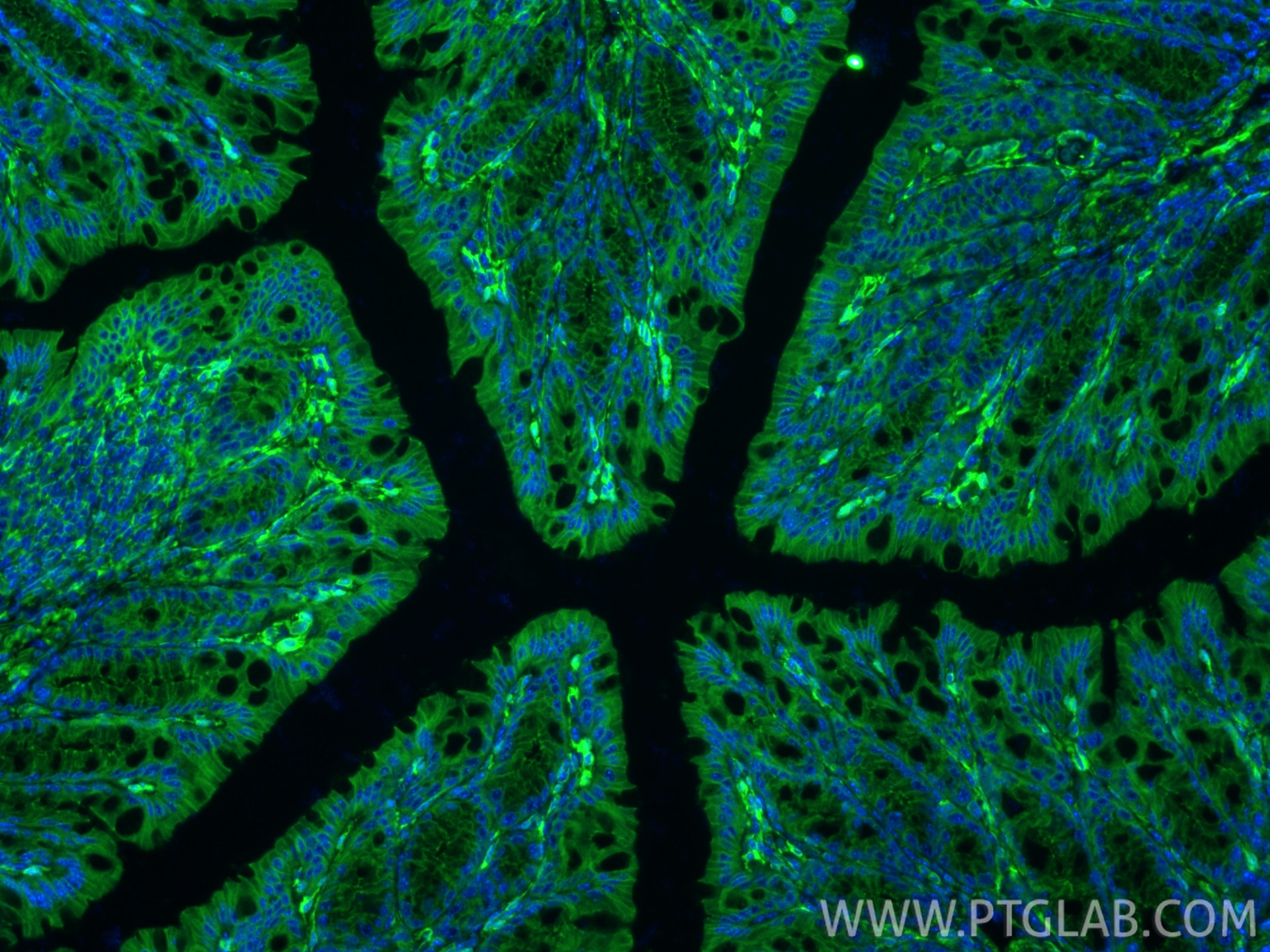 Immunofluorescence (IF) / fluorescent staining of mouse colon tissue using Vinculin Recombinant monoclonal antibody (86930-1-RR)
