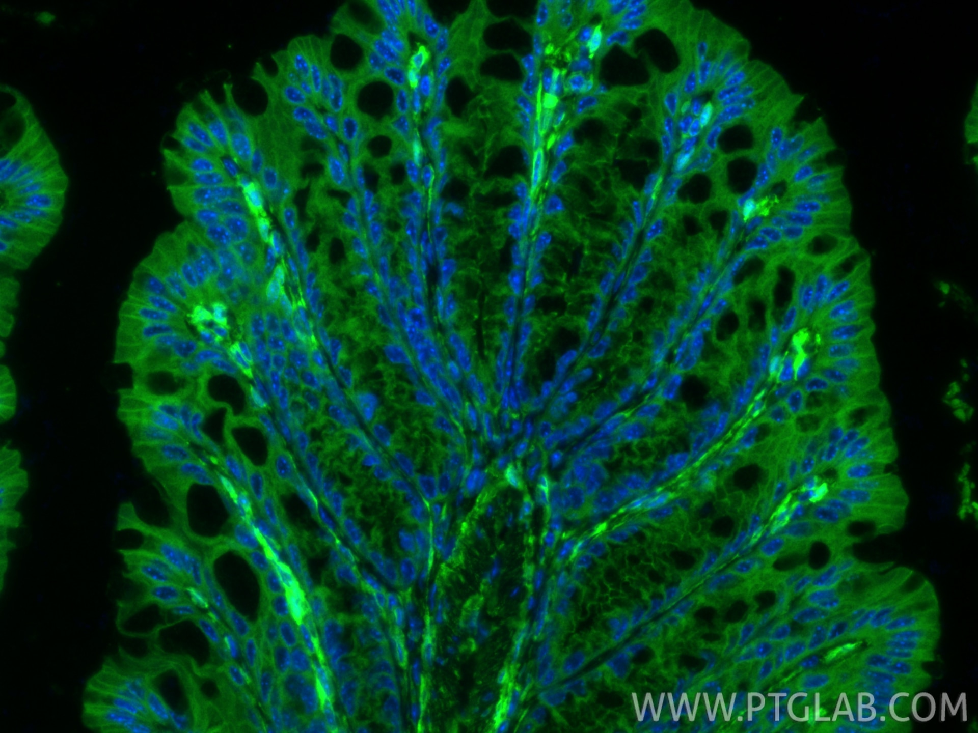 Immunofluorescence (IF) / fluorescent staining of mouse colon tissue using Vinculin Recombinant monoclonal antibody (86930-1-RR)