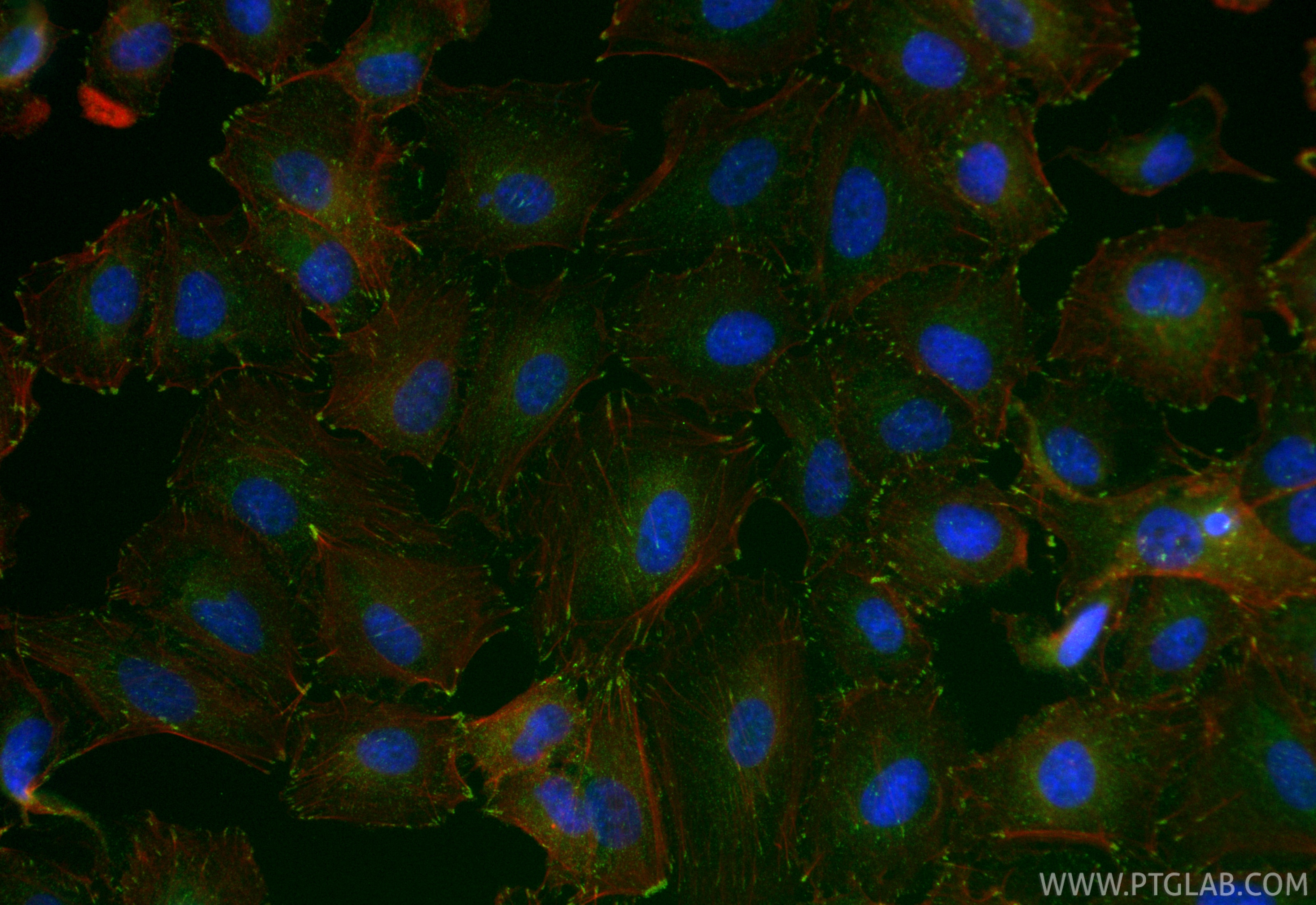 IF Staining of A549 using 86930-1-RR Immunofluorescence (IF) / fluorescent staining of A549 cells using Vinculin Recombinant monoclonal antibody (86930-1-RR)