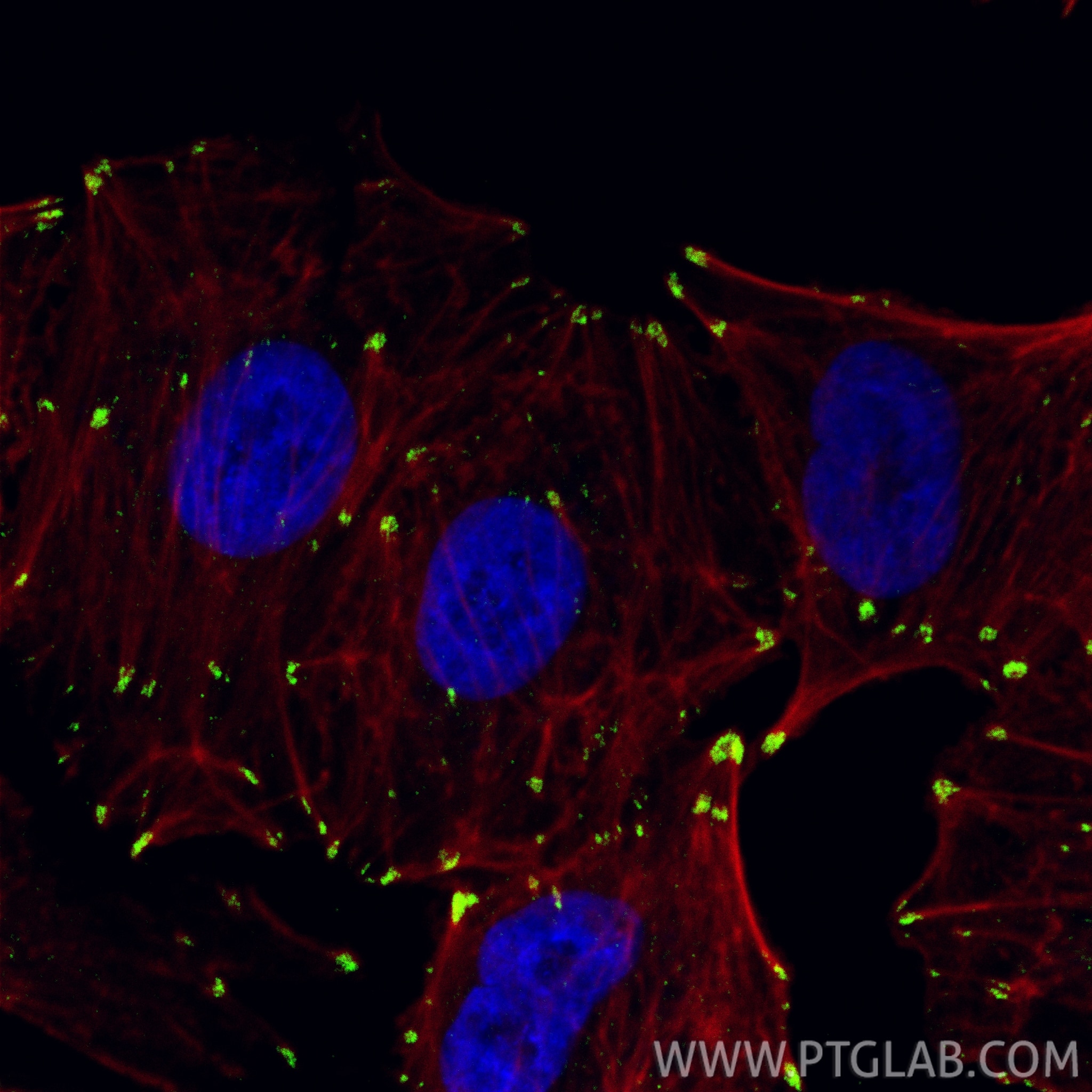 IF Staining of A549 using 86930-1-RR Immunofluorescence (IF) / fluorescent staining of A549 cells using Vinculin Recombinant monoclonal antibody (86930-1-RR)
