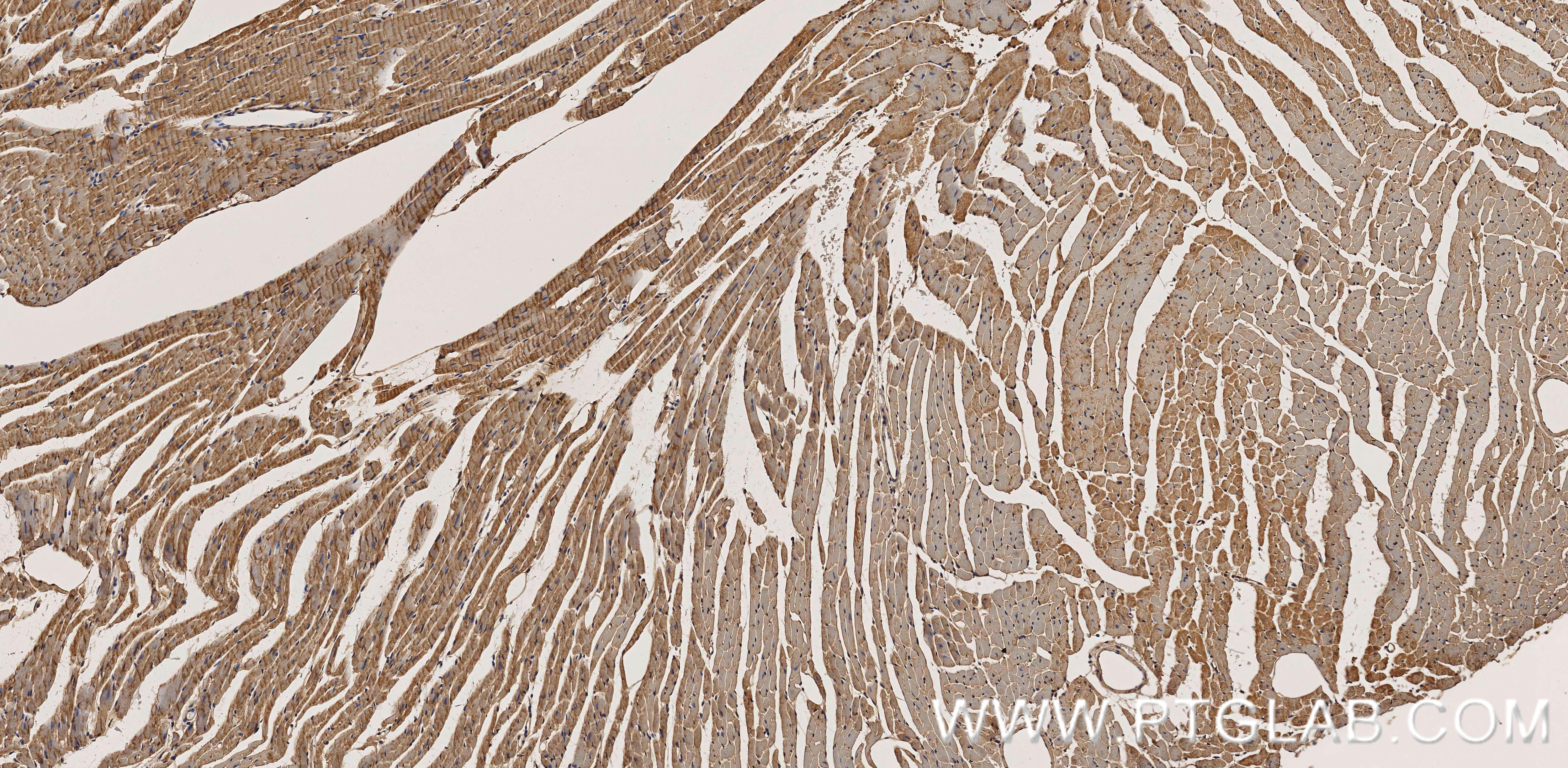 Immunohistochemistry (IHC) staining of mouse heart tissue using Vinculin Recombinant monoclonal antibody (86930-1-RR)