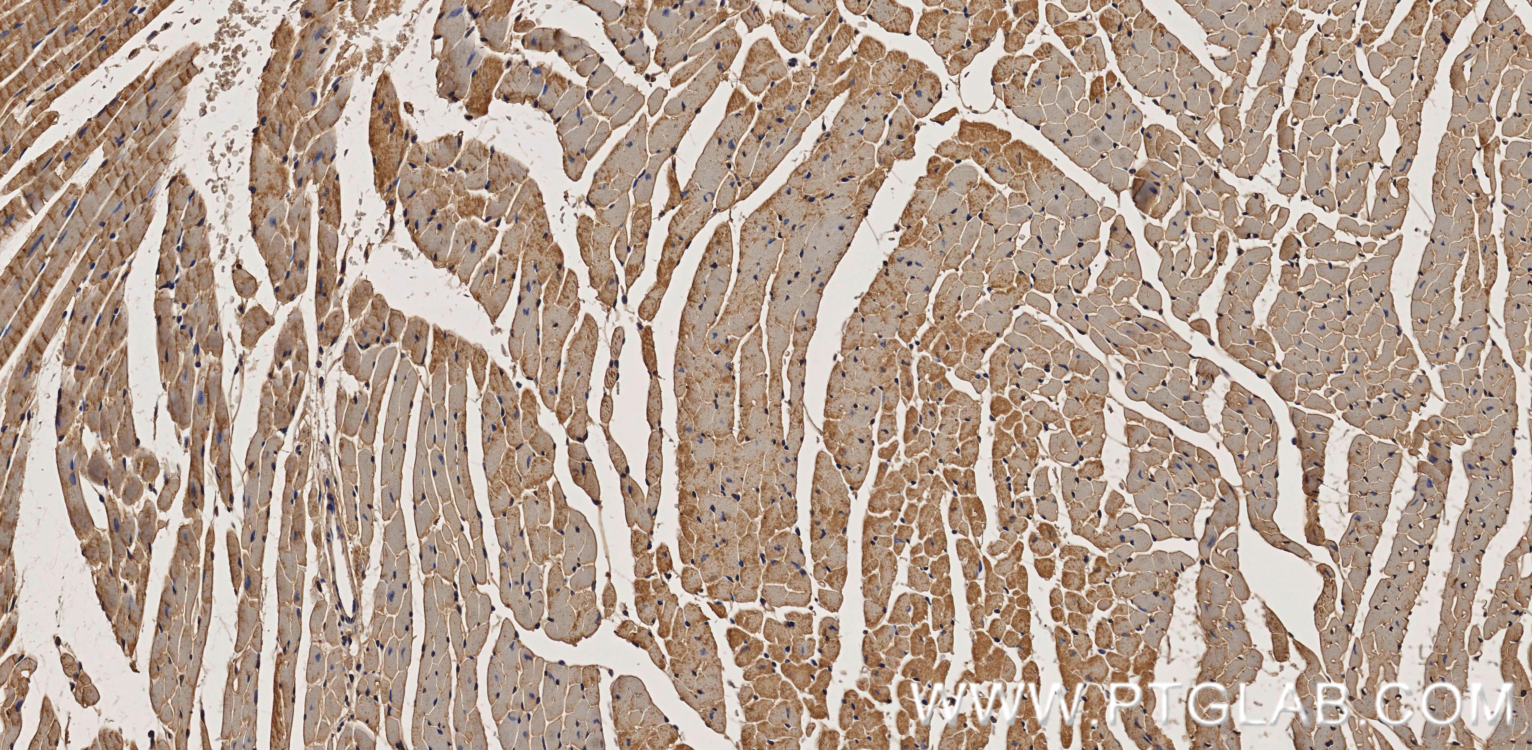 Immunohistochemistry (IHC) staining of mouse heart tissue using Vinculin Recombinant monoclonal antibody (86930-1-RR)
