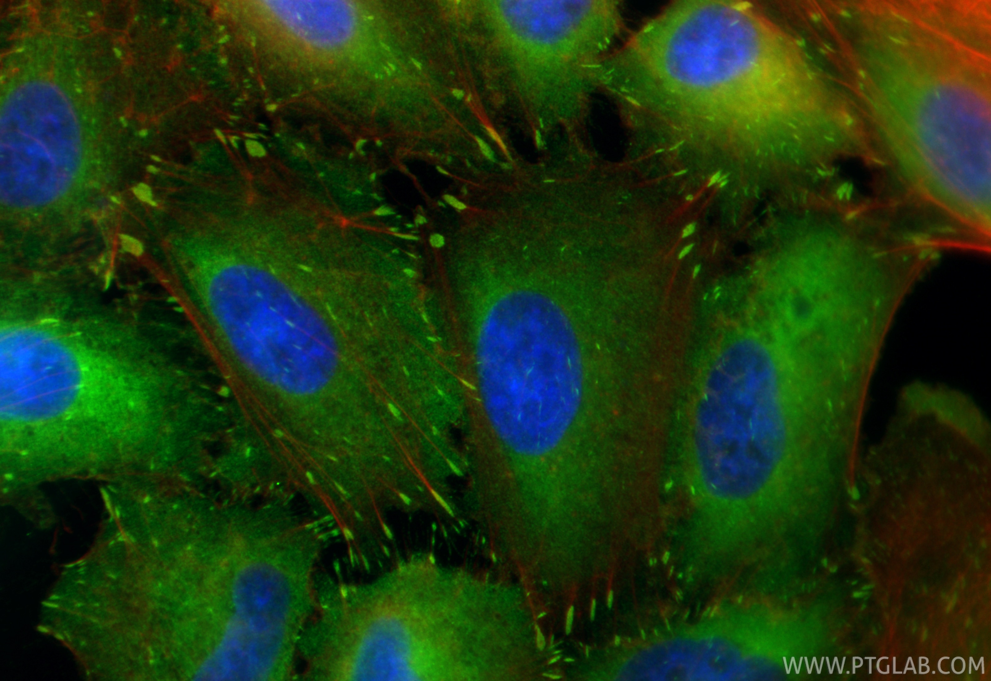 Immunofluorescence (IF) / fluorescent staining of A549 cells using CoraLite® Plus 488-conjugated Vinculin Polyclonal  (CL488-26520)