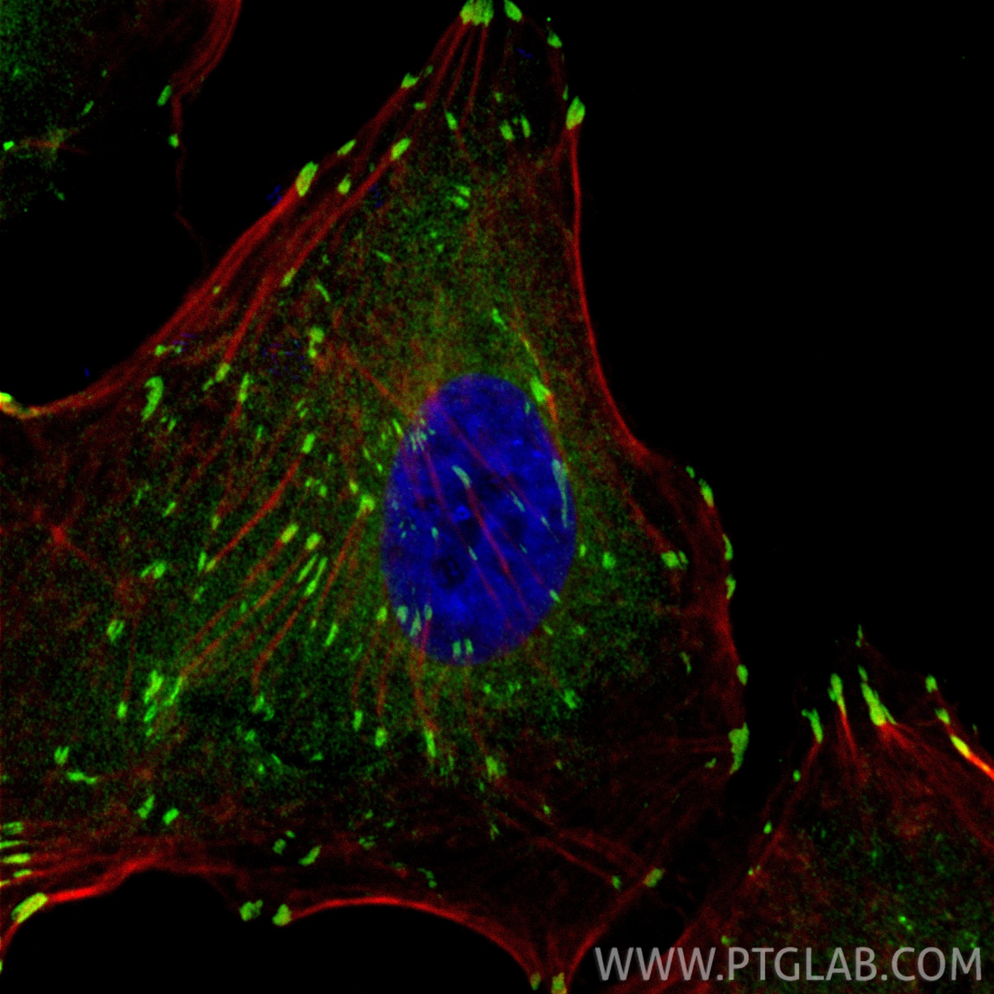 IF Staining of A549 using CL488-26520 Immunofluorescence (IF) / fluorescent staining of A549 cells using CoraLite® Plus 488-conjugated Vinculin Polyclonal (CL488-26520)