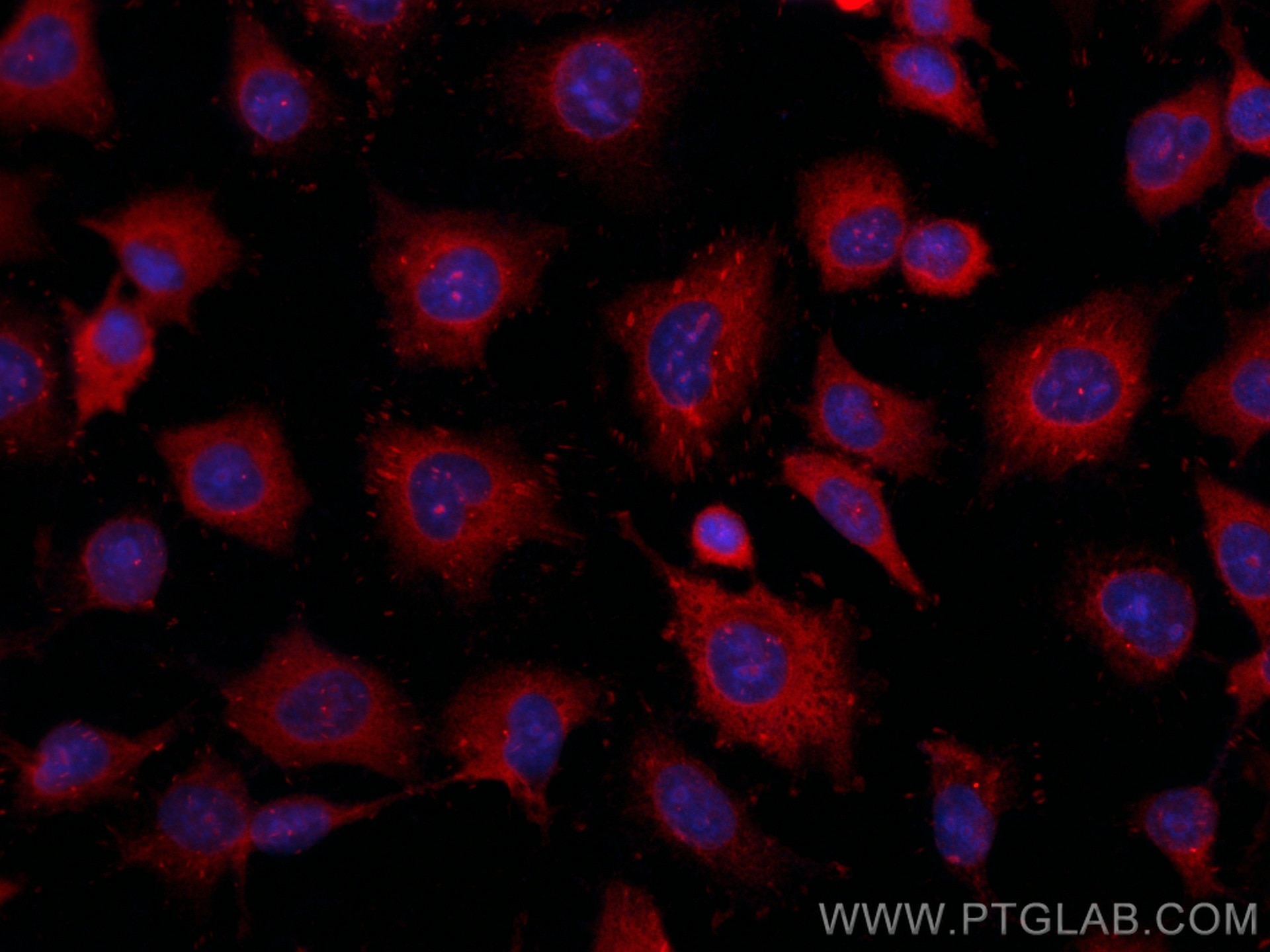 Immunofluorescence (IF) / fluorescent staining of HUVEC cells using CoraLite®594-conjugated Vinculin Polyclonal antibo (CL594-26520)