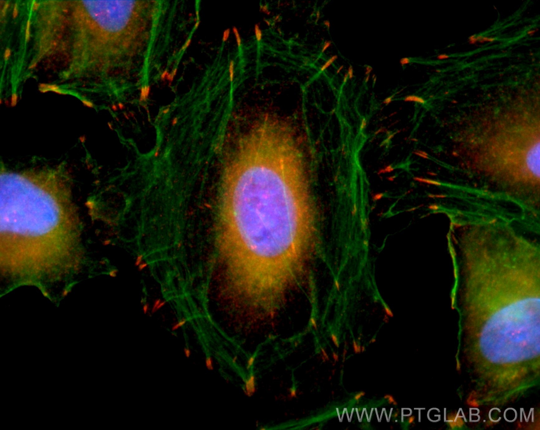 Immunofluorescence (IF) / fluorescent staining of A549 cells using CoraLite®594-conjugated Vinculin Polyclonal antibo (CL594-26520)