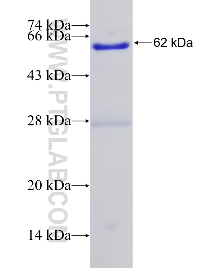 Vinculin fusion protein Ag24942 SDS-PAGE