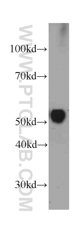 Western Blot (WB) analysis of human testis tissue using Vitamin D binding protein Monoclonal antibody (66175-1-Ig)