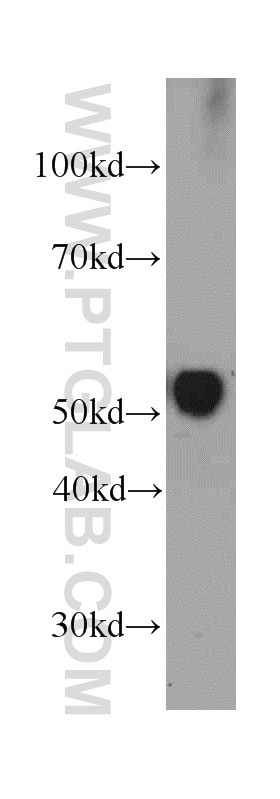 Vitamin D binding protein