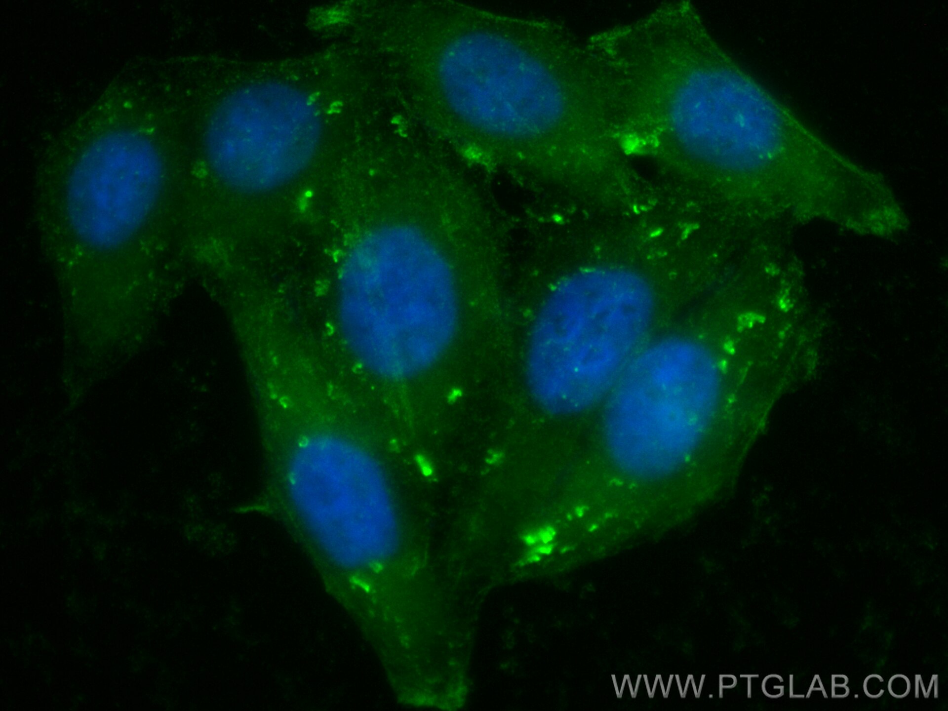 Immunofluorescence (IF) / fluorescent staining of HepG2 cells using CoraLite® Plus 488-conjugated Vitamin D binding pr (CL488-66175)