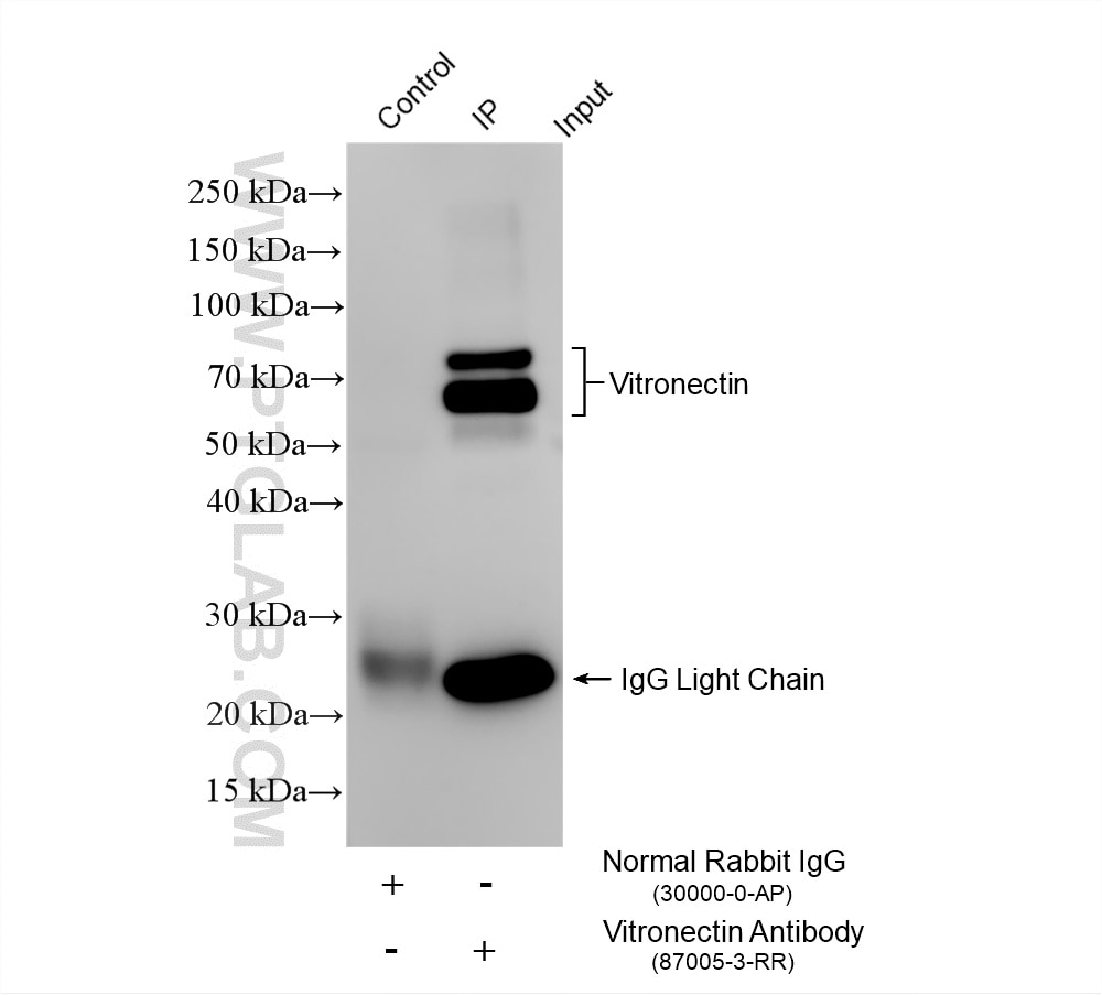 Immunoprecipitation (IP) experiment of human plasma using Vitronectin/S-protein Recombinant monoclonal antib (87005-3-RR)