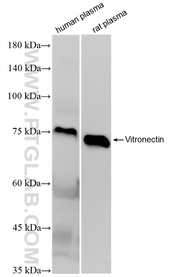WB analysis using 87005-3-RR Western Blot (WB) analysis of various lysates using Vitronectin/S-protein Recombinant monoclonal antib (87005-3-RR)