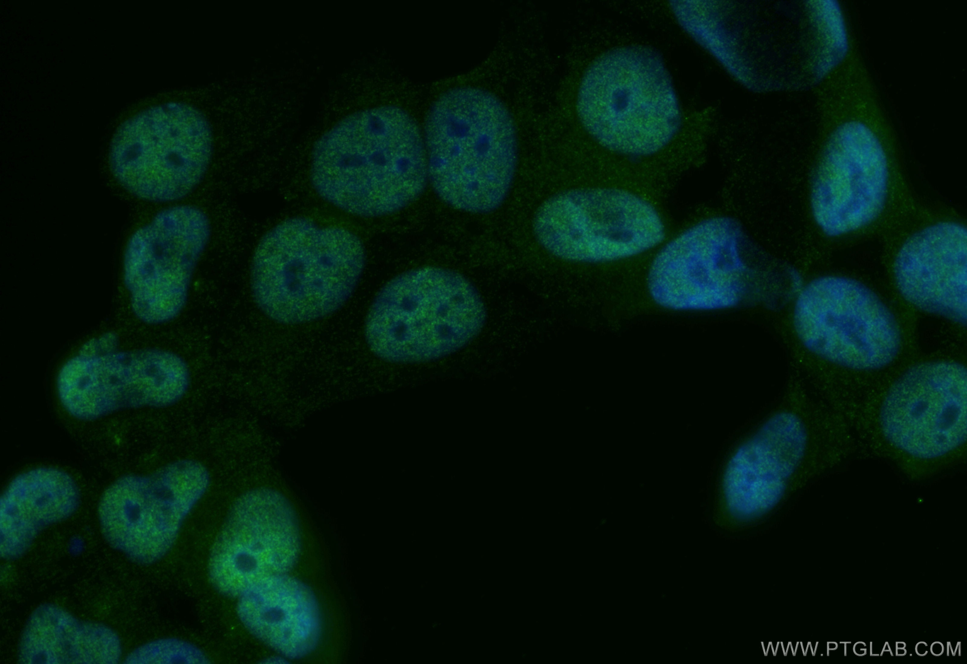 Immunofluorescence (IF) / fluorescent staining of MCF-7 cells using WAC Polyclonal antibody (20519-1-AP)