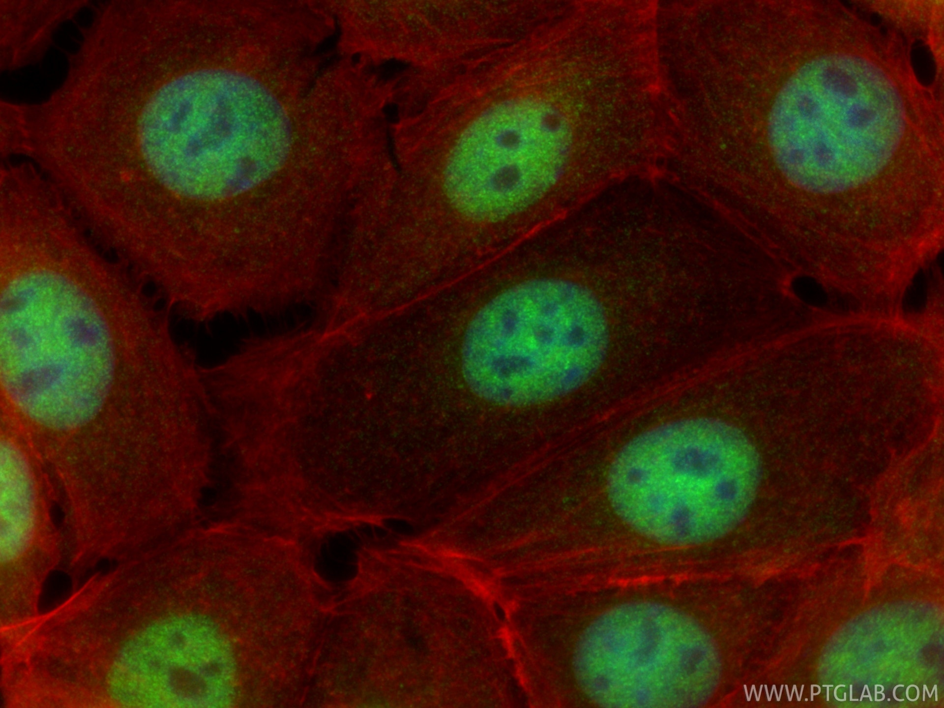 IF Staining of MCF-7 using 20519-1-AP Immunofluorescence (IF) / fluorescent staining of MCF-7 cells using WAC Polyclonal antibody (20519-1-AP)