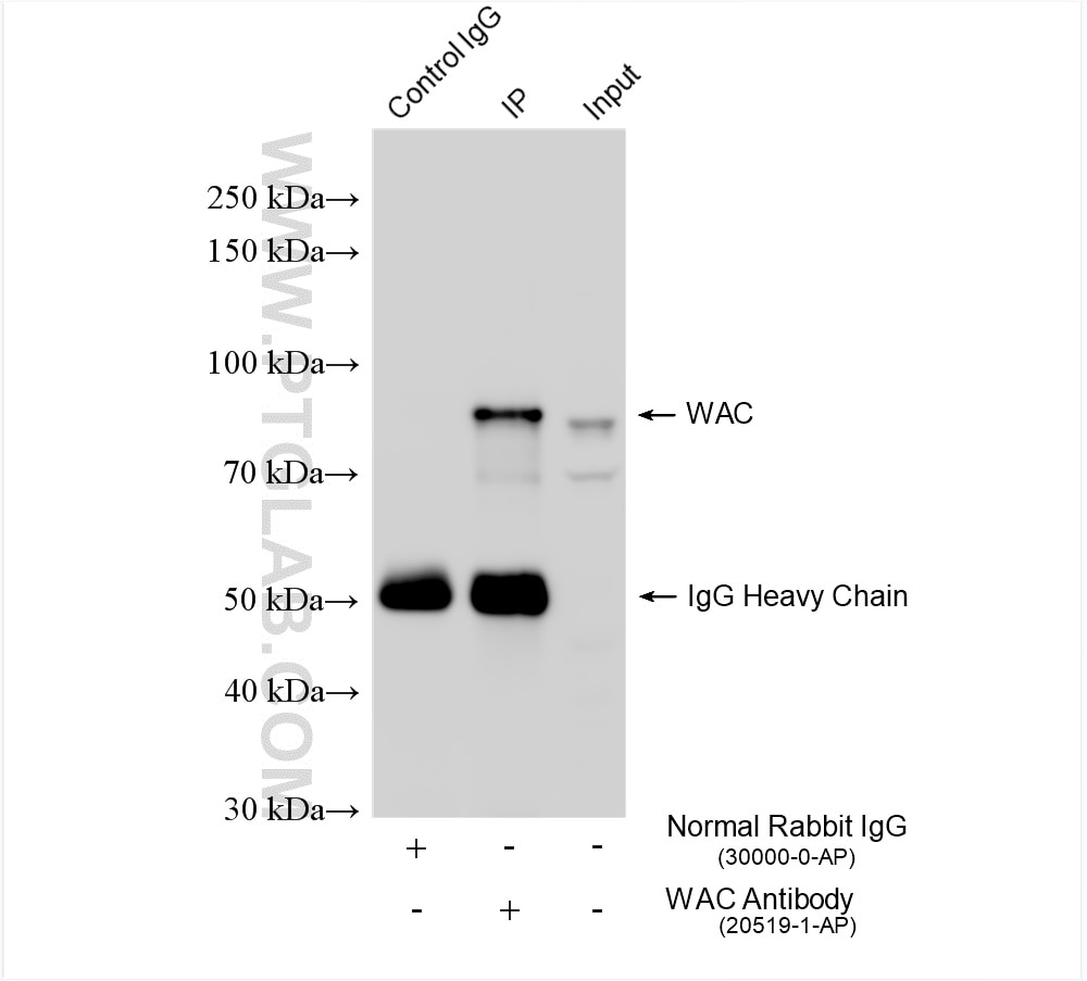Immunoprecipitation (IP) experiment of HeLa cells using WAC Polyclonal antibody (20519-1-AP)