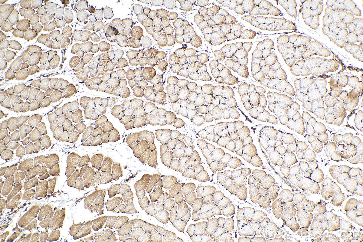 Immunohistochemistry (IHC) staining of mouse skeletal muscle tissue using WAPL; WAPAL Polyclonal antibody (16370-1-AP)