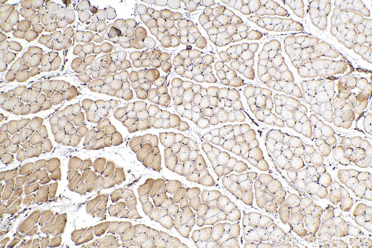 IHC staining of mouse skeletal muscle using 16370-1-AP