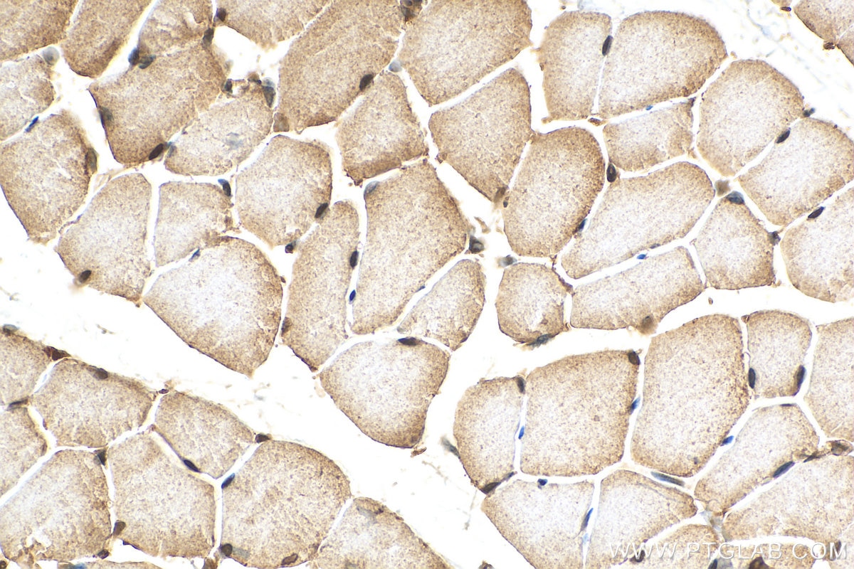 Immunohistochemistry (IHC) staining of mouse skeletal muscle tissue using WAPL; WAPAL Polyclonal antibody (16370-1-AP)