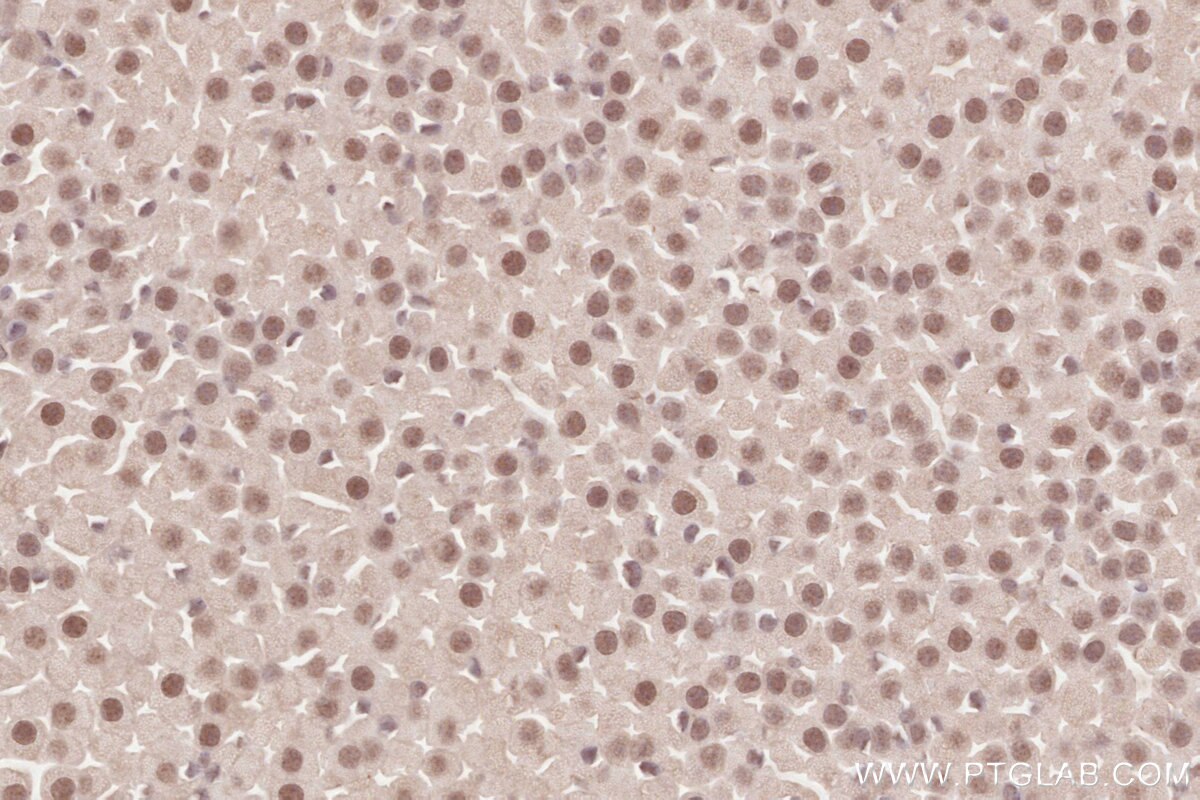 Immunohistochemistry (IHC) staining of mouse adrenal gland tissue using WAPL Polyclonal antibody (16370-1-AP)
